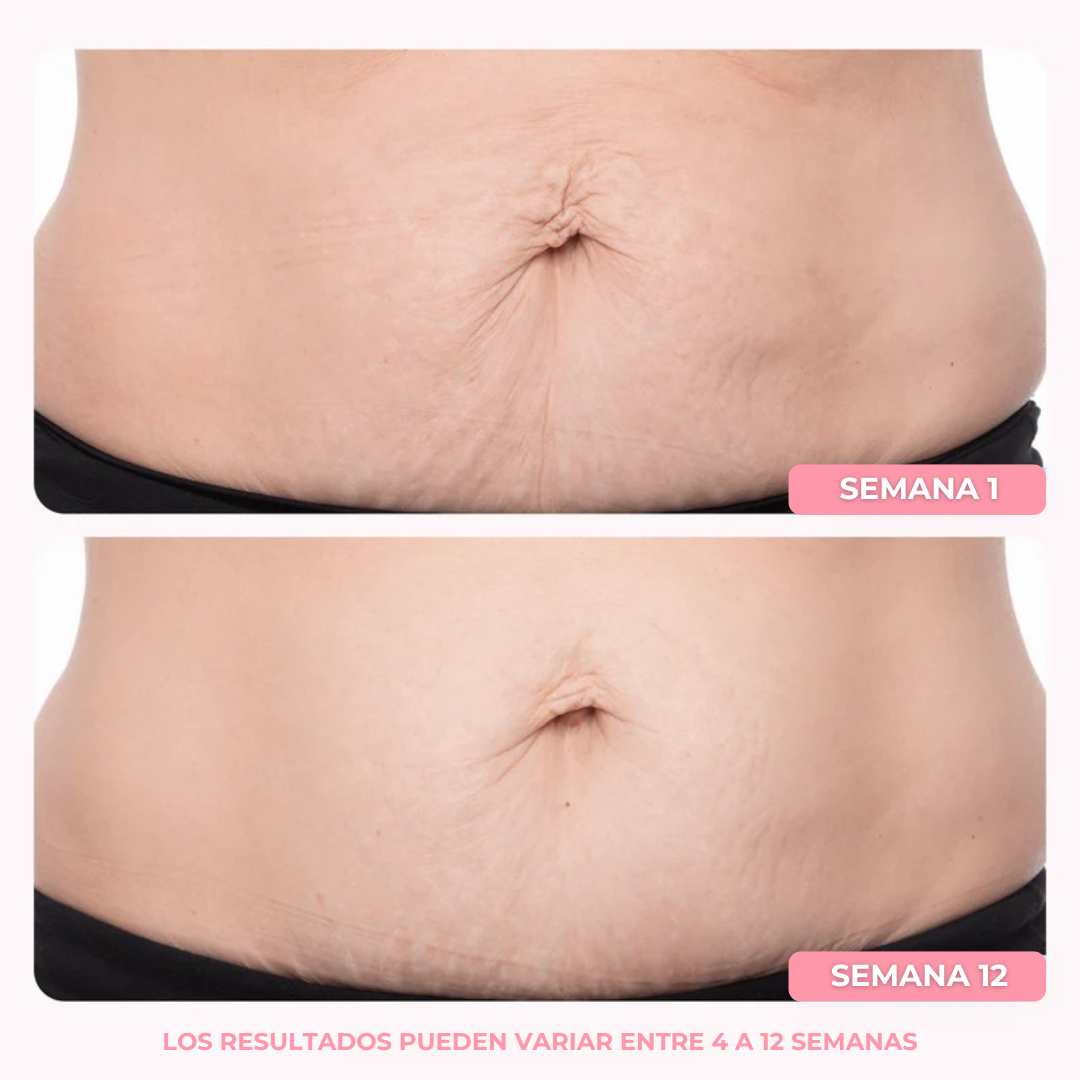 Crema Tonificante | Elimina la flacidez del cuerpo