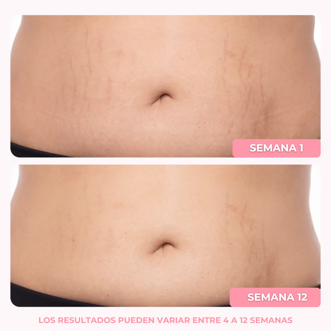 Crema Tonificante | Elimina la flacidez del cuerpo