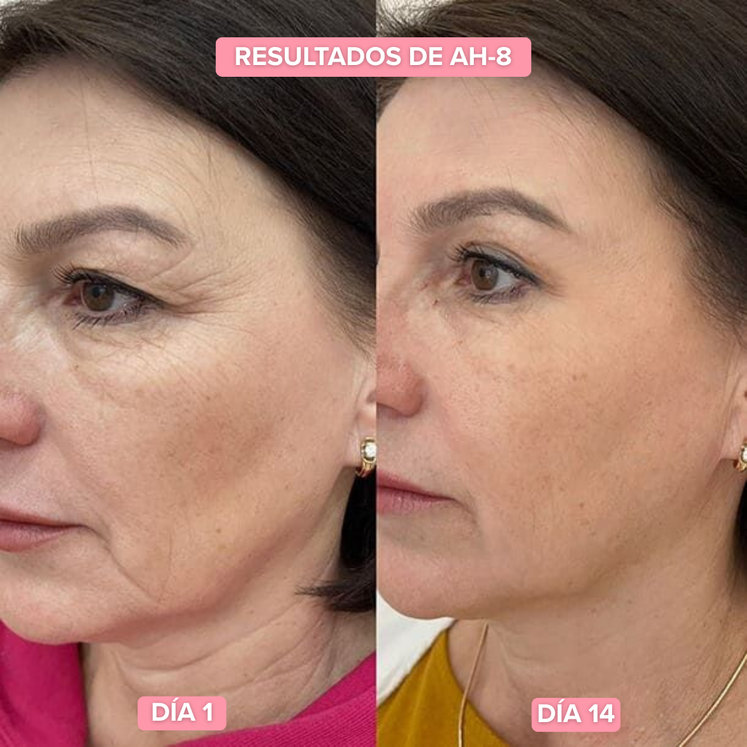 AH8 + Crema Nuba | Adiós cuello de pavo y cara de cansada