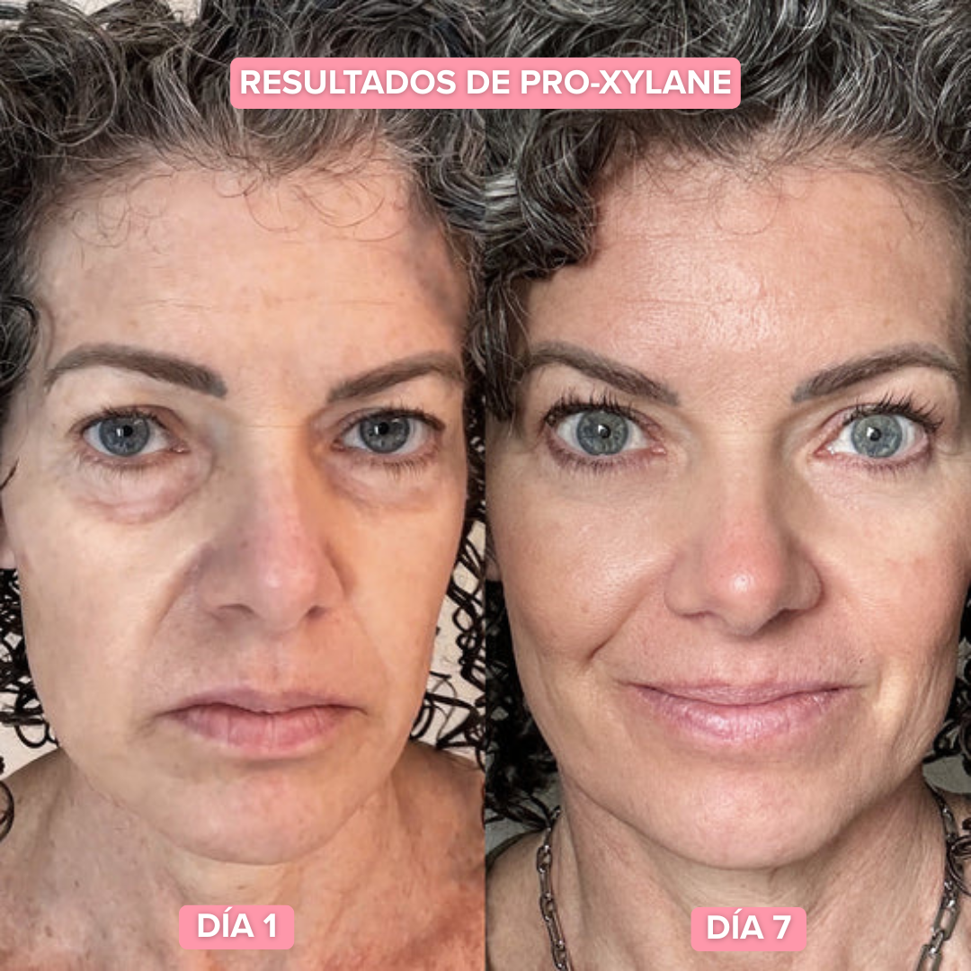 AH8 + Crema Nuba | Adiós cuello de pavo y cara de cansada
